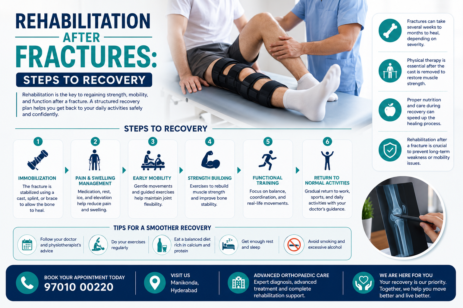 Rehabilitation After Fractures: Steps to Recovery